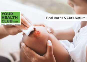 Treat Minor Burns and Cuts