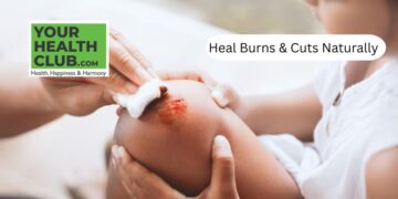 Treat Minor Burns and Cuts